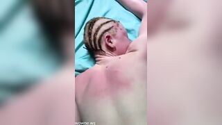 Albinos