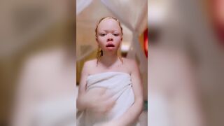 Albinos Tanzanie