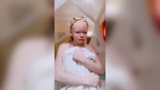 Albinos Tanzanie